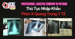 THỦ TỤC NHẬP KHẨU PHIM X QUANG TRONG Y TẾ